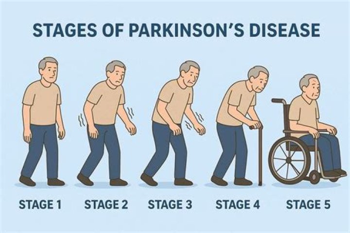 Does Mark Levin Have Parkinson's? Understanding His Health Journey